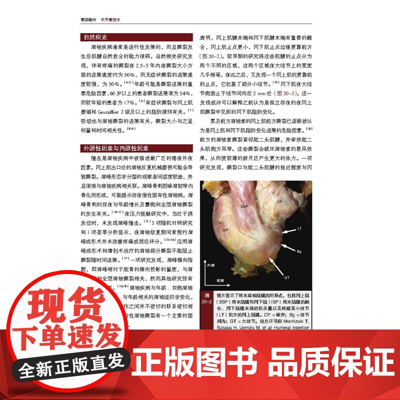 肩部与肘部 美国骨科医师学会骨科知识更新 骨科 创伤骨科 肩肘外科学 肩袖修复 AAOS 北京科学技术高清大图