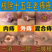 【苏宁正品】痔疮药膏消肉球痔疮膏内痔外痔混合痔痔疮药膏治便血止痒定制定金