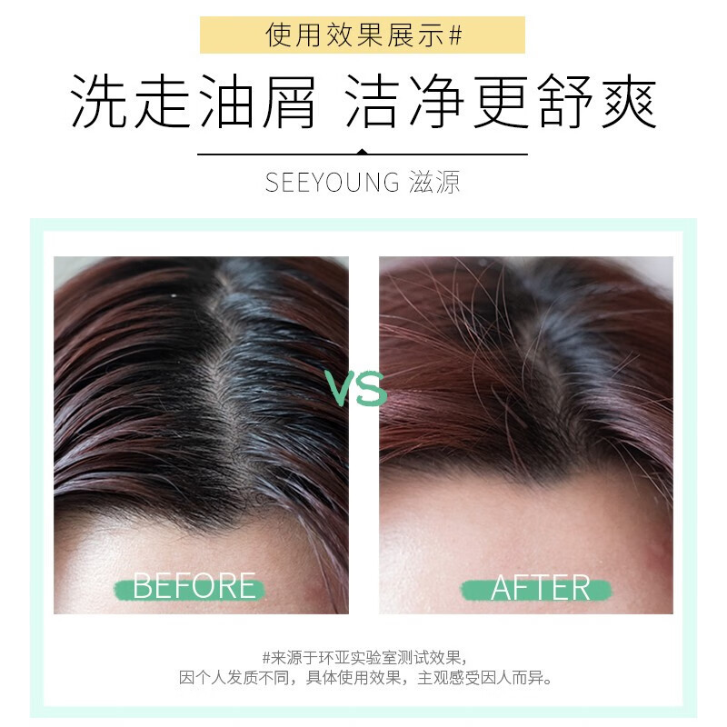 滋源(seeyoung) 森林曦风 净屑香氛 535ml 洗发水 (计价单位:瓶)高清大图