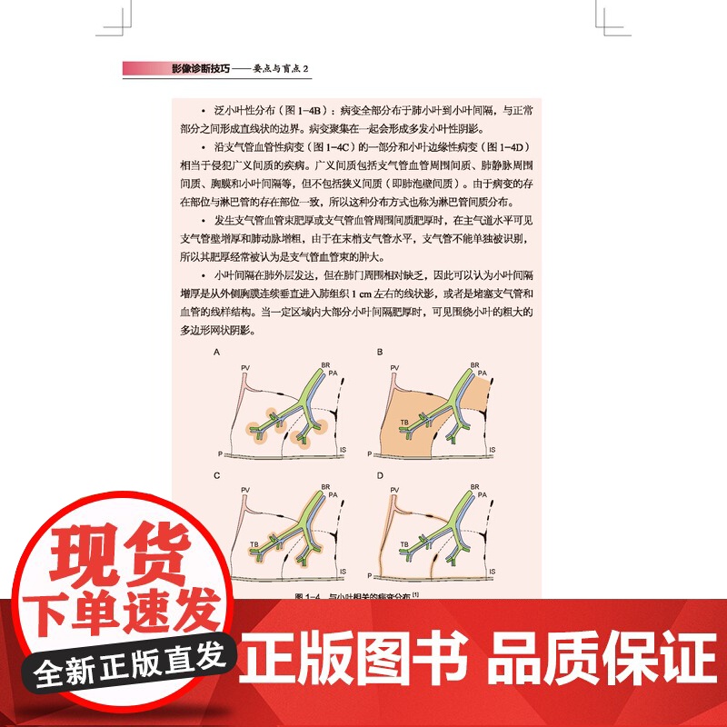 影像诊断技巧 要点与盲点 2 影像诊断 读片技巧 影像解剖 专家教你快速掌握影像读片技巧 北京科学技术高清大图