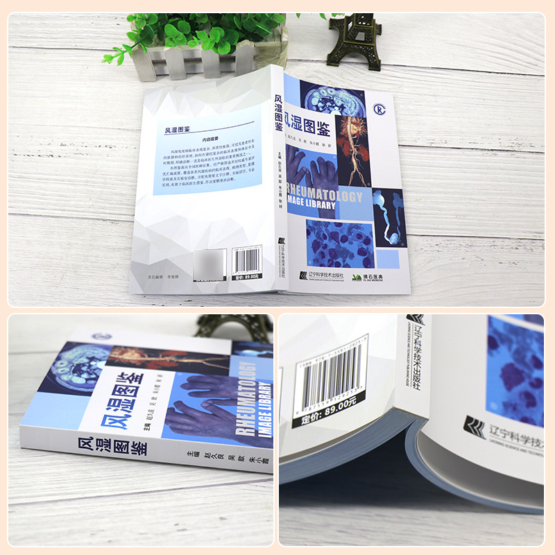[醉染正版]风湿图鉴 赵久良 吴歆 朱小霞 耿研 风湿免疫病学临床图鉴图谱图谱病理学影像学检查诊断书籍风湿免疫科风湿病书高清大图