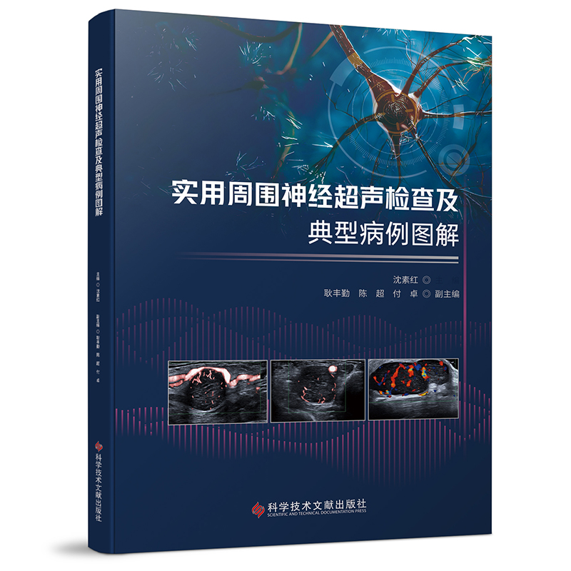 实用周围神经超声检查及典型病例图解+超声掌中宝 肌骨超声诊断技术2册 [正版]实用周围神经超声检查及典型病例图解+超声掌高清大图