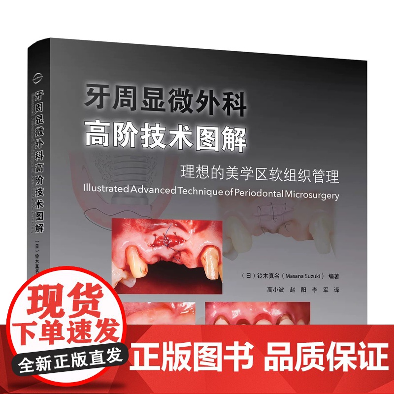 正版全新 牙周显微外科高阶技术图解 理想的美学区软组织管理 高小波 赵阳 李军 译 辽宁科学技术出版社978755913高清大图