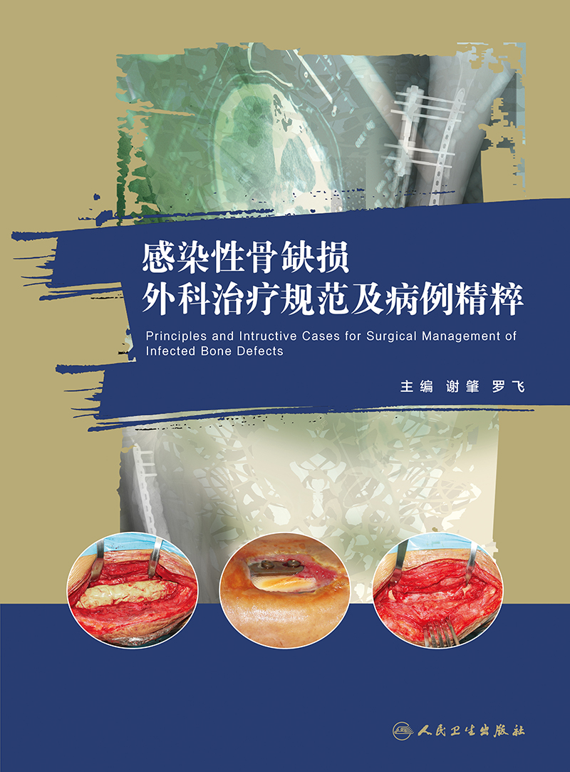 [正版]感染性骨缺损外科治疗规范及病例精粹 谢肇 罗飞 骨缺损缺失骨感染控制死腔处理治疗病例病变骨科学手术外科学修复实高清大图
