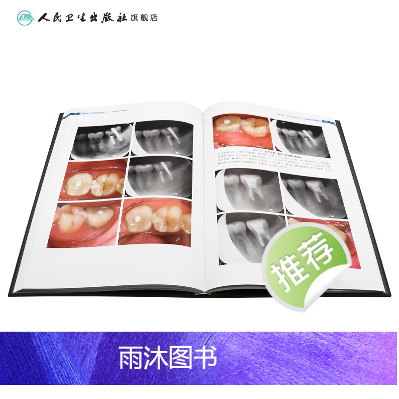 [正版]显微根管外科疑难病例解析彩色图谱 2023年9月参考书 9787117352062高清大图