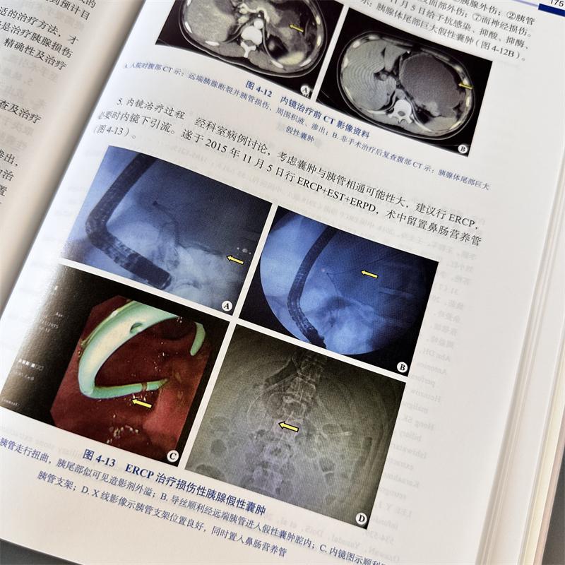 [正版]胆胰疾病ERCP诊断与治疗 周文策,李汛 编 内科学疾病诊治资料图书 医学类书籍 科学出版高清大图