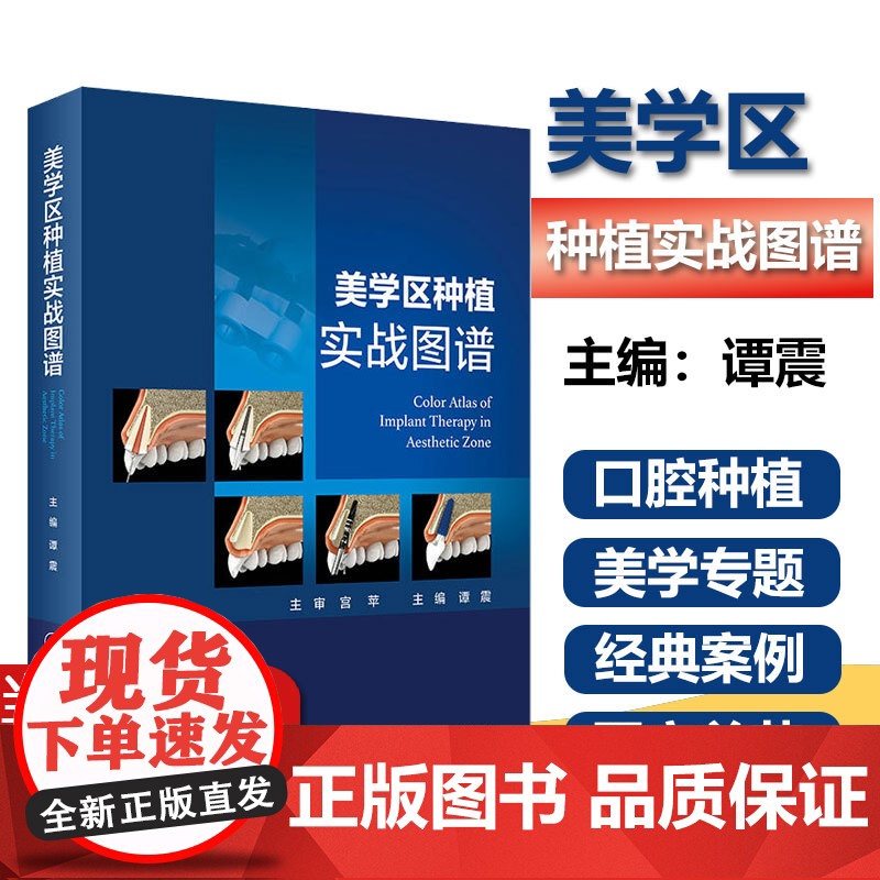 美学区种植实战图谱 谭震 口腔科学种植的精准植入技巧书籍口腔修复口腔种植学缺牙区局部整体综合评估诊疗美学种植难点及知识点高清大图