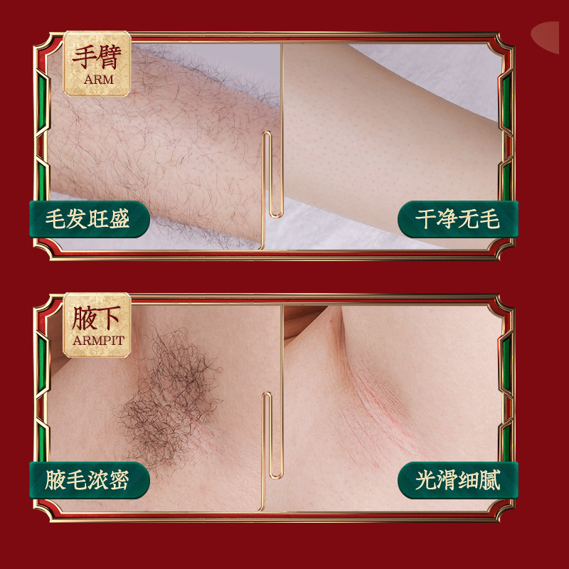 正品脱毛慕斯喷雾脱毛膏套装去腋毛喷雾腋下腿毛非阴毛私处全身男女士学生不永久