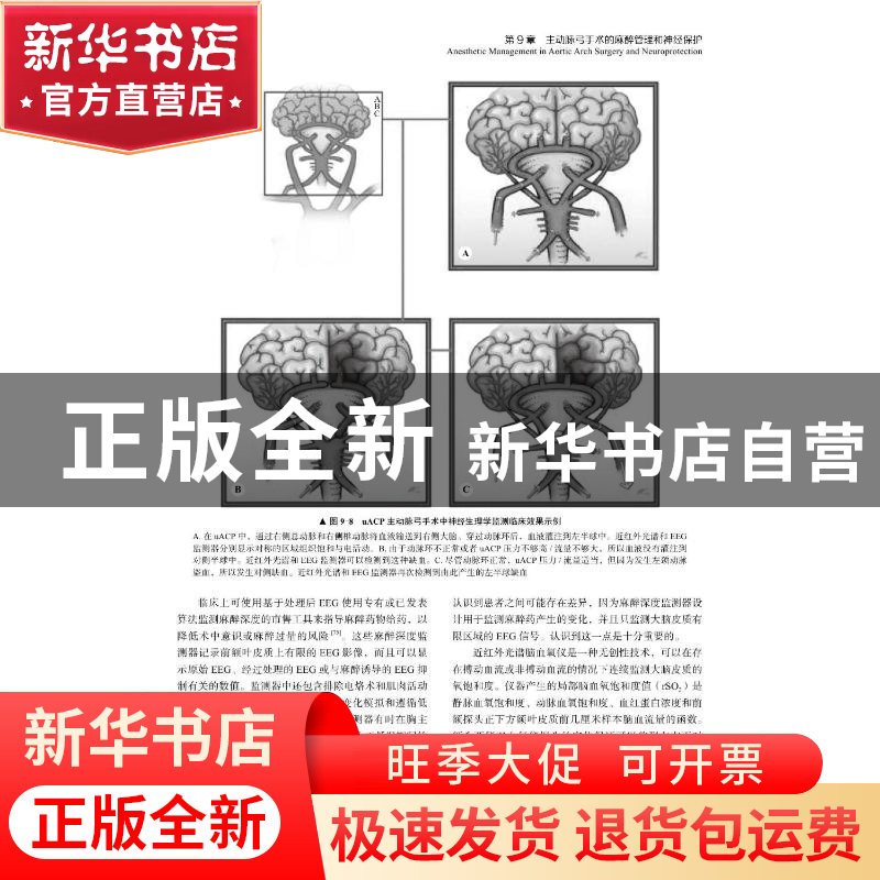 正版 围手术期心脏麻醉与外科循证实践高清大图
