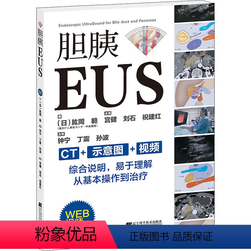 【正版】胆胰EUS (日)肱岡 範 著 宫健,刘石,祝建红 译 内科学生活 书店图书籍 辽宁科学技术出版社