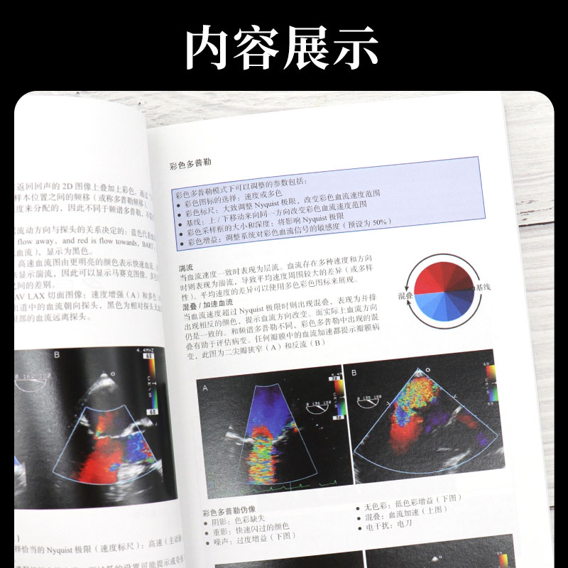 [正版]围术期二维经食管超声心动图实用手册 第2版 第二版 冠状动脉疾病 舒张功能 Annette Vegas著 97高清大图