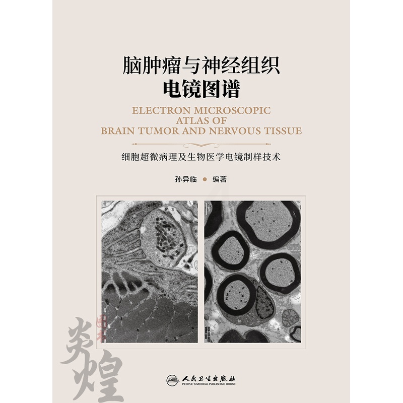 [醉染正版]脑肿瘤与神经组织电镜图谱 孙异临编著 人民卫生出版社9787117269025高清大图