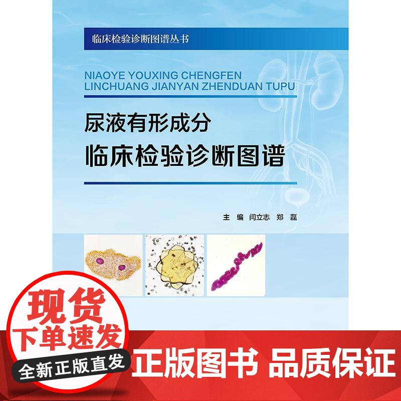 尿液有形成分临床检验诊断图谱高清大图