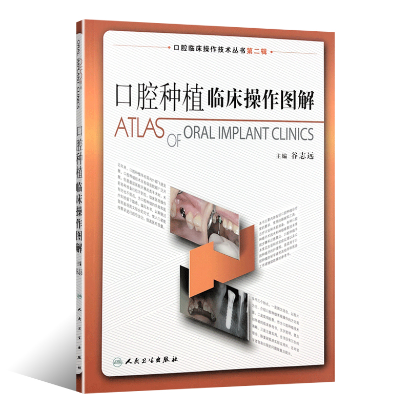 [正版] 口腔种植临床操作图解 拔牙技巧学义齿全瓷修复颌面外科正畸黏膜病学牙髓之路儿童牙科病历根管治疗口腔医学书籍高清大图