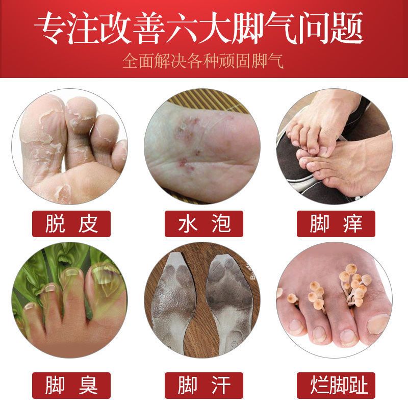 图书>期刊/杂志>男士>图书其它>去脚气脚臭脚痒脚气治疗脚气膏脱皮除