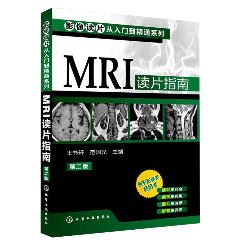[醉染正版]影像读片从入门到精通系列(第二版)CT读片指南+MRI读片指南+X线读片指南套装3册医学超声影像诊断 学诊断高清大图