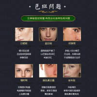女神秘笈嫩白祛斑霜素颜面霜淡斑精华产品提亮肤色嫩肤补水保湿晚日霜男女各种肤质黑色褐斑晒斑辐射斑痘印遗传斑通用50g
