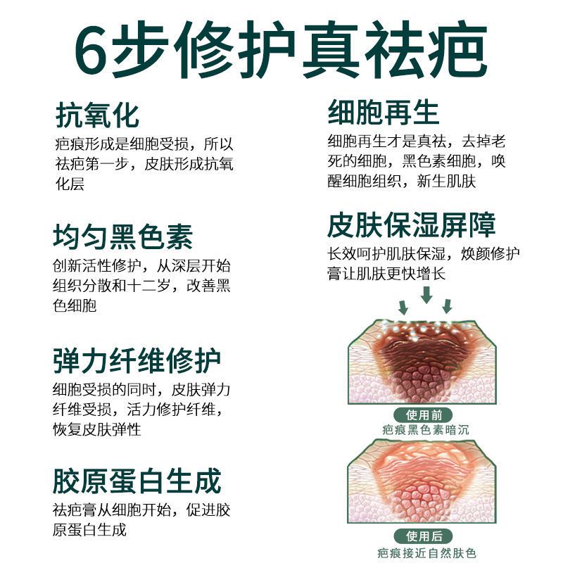 [快速去疤]淡化增生凹凸疤妊娠纹去新老疤烧伤痘印疤膏修复无痕 升级装一瓶装
