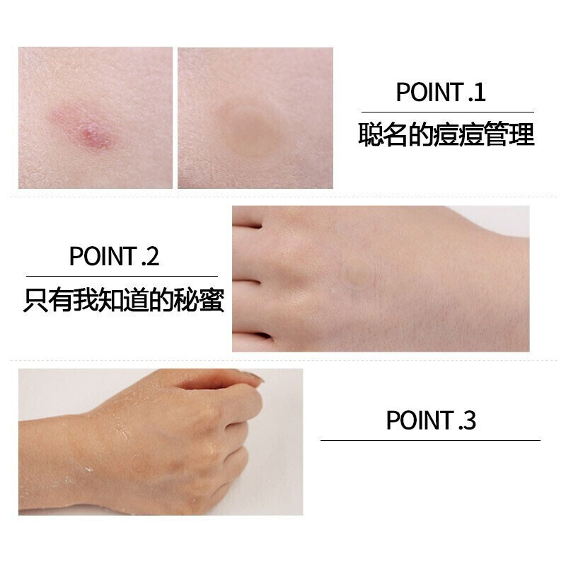 VT韩国老虎痘痘贴隐形遮痘人工皮物理净痘贴隐形可上妆官方正品