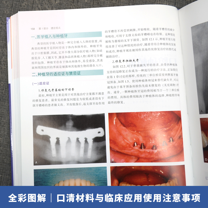 [醉染正版]正版 临床口腔材料理论实践与病例解析 第5版 李潇 译 口腔材料学 口腔病例解析图谱书籍 正畸修复技术 可摘高清大图