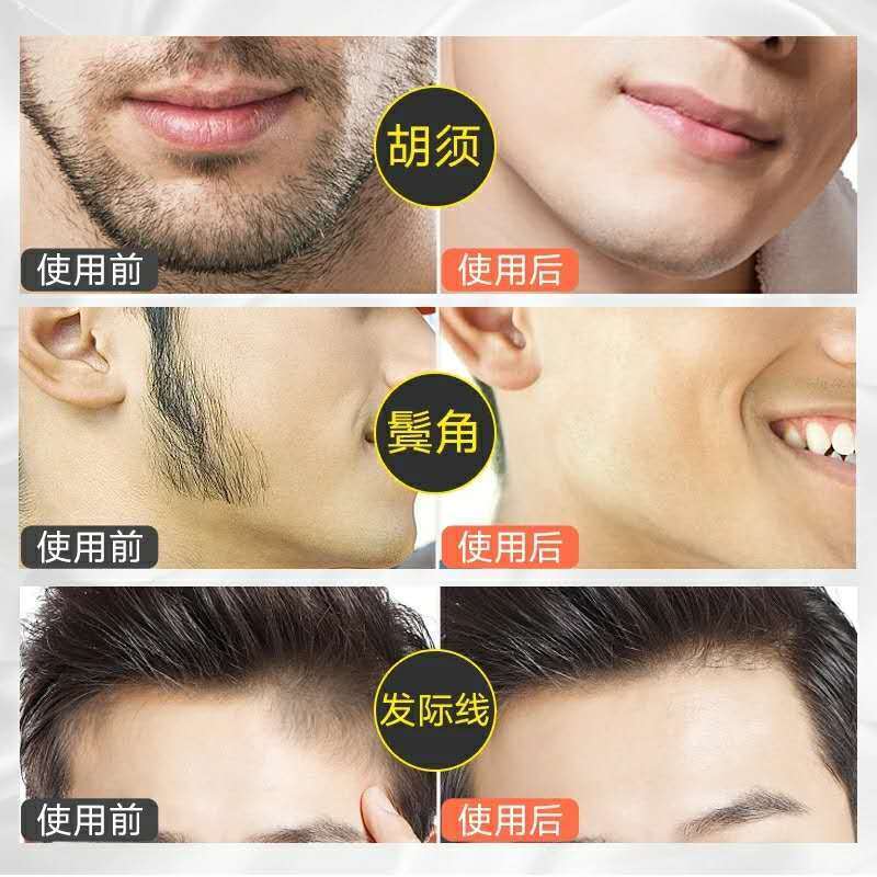 [男士专业去胡子]脱毛膏去胡须男士脸部毛腿毛腋下手毛全身脱毛 QMG