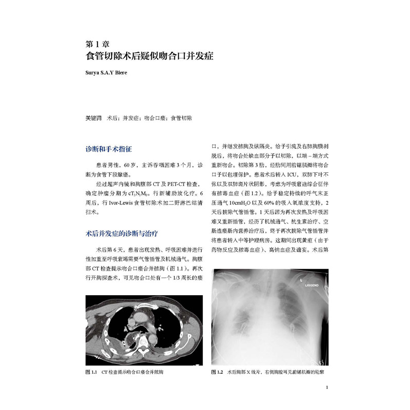 醉染图书消化道术后并发症实例分析9787571412135高清大图