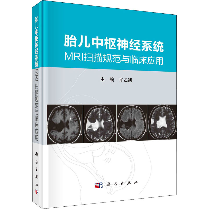 [M]胎儿中枢神经系统MRI扫描规范与临床应用-9787030684813高清大图