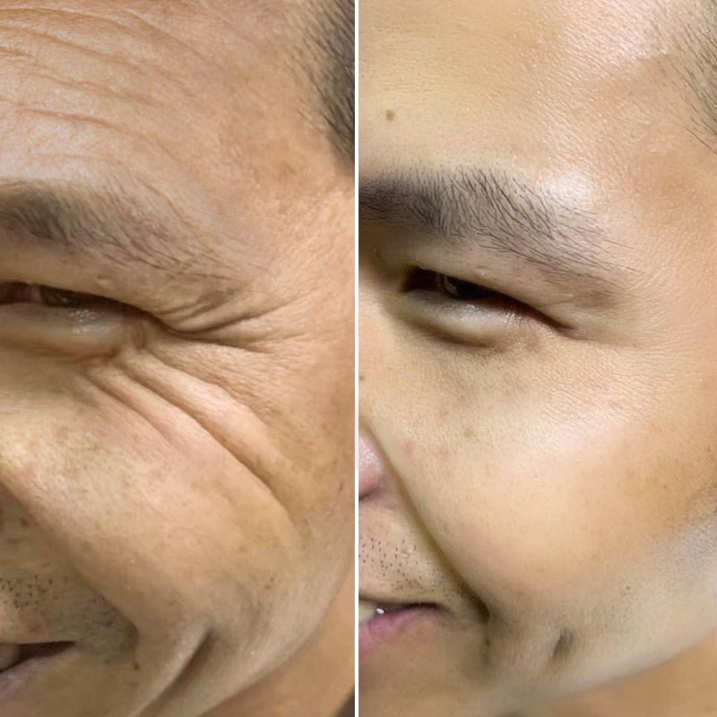 皱纹克星抗皱祛皱纹祛抬头纹鱼尾纹法令纹紧致护肤面部精华液