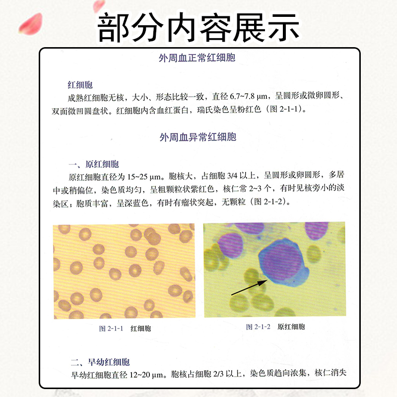 [醉染正版]正版 实用血细胞检验图谱 王青主编 血液学 血液检验 血细胞形态学 临床实用医学书籍 上海科学技术出版 血液高清大图