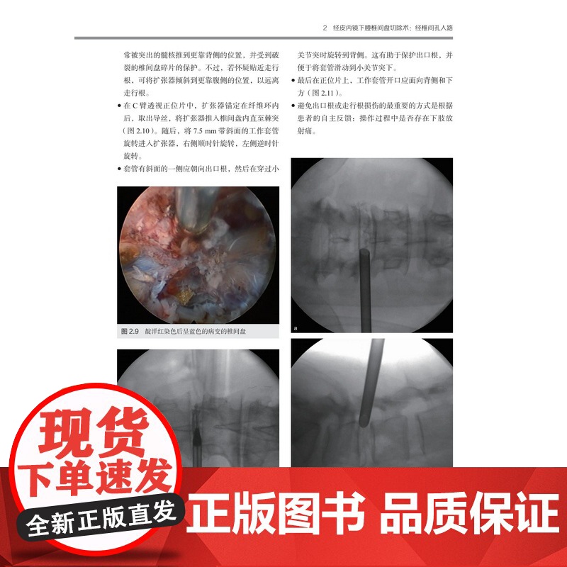 脊柱内镜手术技术 视频配合学习 外科手术图解 临床应用 手术技巧分析 病例分析 北京科学技术高清大图