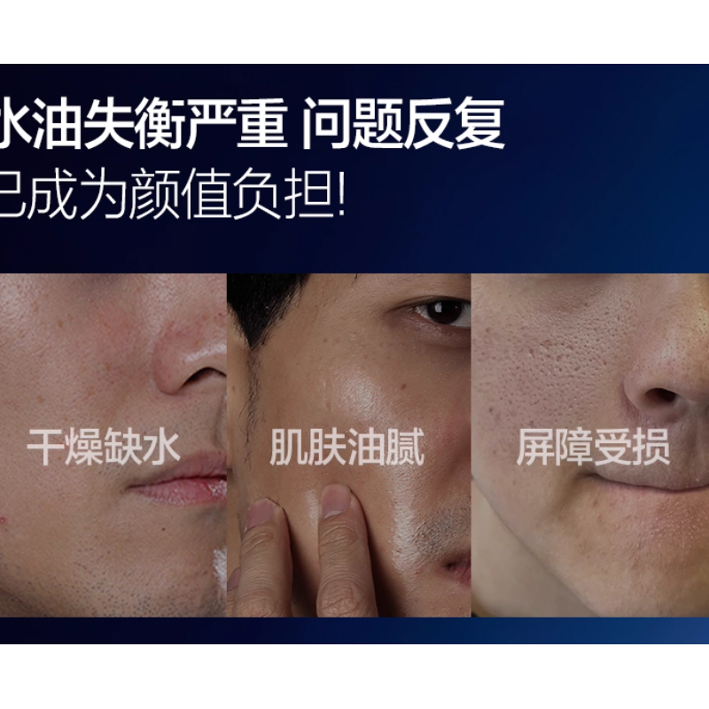 柏缇男士平衡保湿水 160ml NS16001高清大图