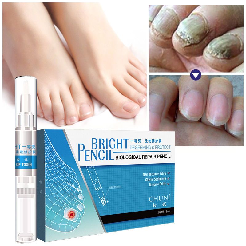 膜技术灰甲一笔亮灰甲液生长修护液亮甲专用买一支发二支6ml>800_800