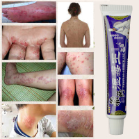 藏药湿毒王药膏苗药牛皮癣立克大腿内侧瘙痒股癣药膏汗斑藓白斑私处龟头炎外阴止痒肛门肛周湿疹皮炎鹅掌风手癣脱皮脚毛囊炎18克