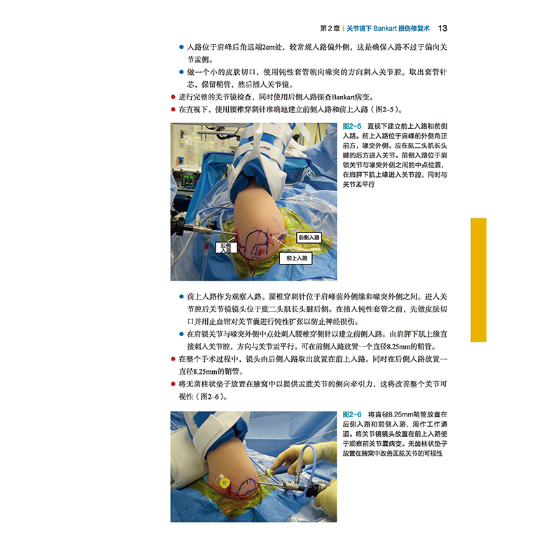 醉染图书运动医学手术技术图谱:技巧与陷阱9787571405144高清大图