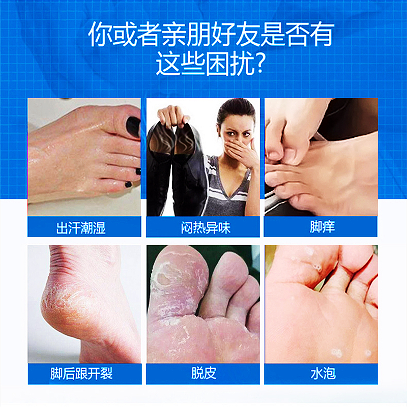 金丫足跟修护膏足霜改善脚痒脱皮开裂水泡粗糙老茧现象80g/支高清大图