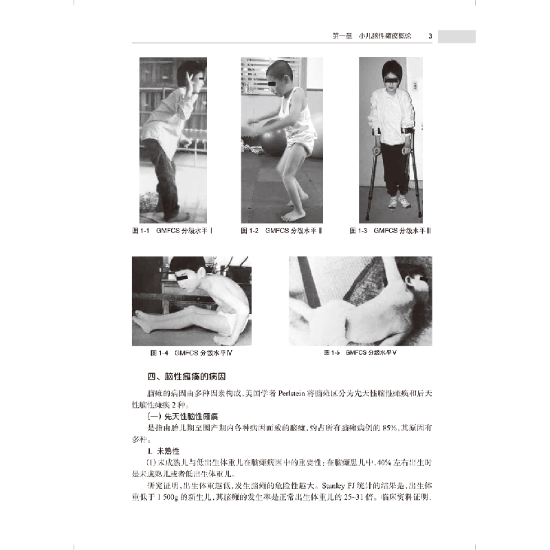 醉染图书小儿脑瘫痪运动治疗实践(第2版)9787117333030高清大图