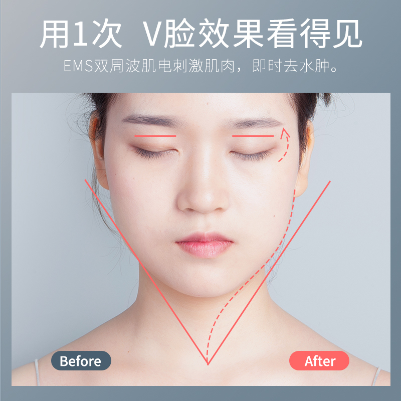 雅萌大白棒面部按摩仪提升脸部下垂美容仪瘦脸滚轮紧致小V脸瘦下巴