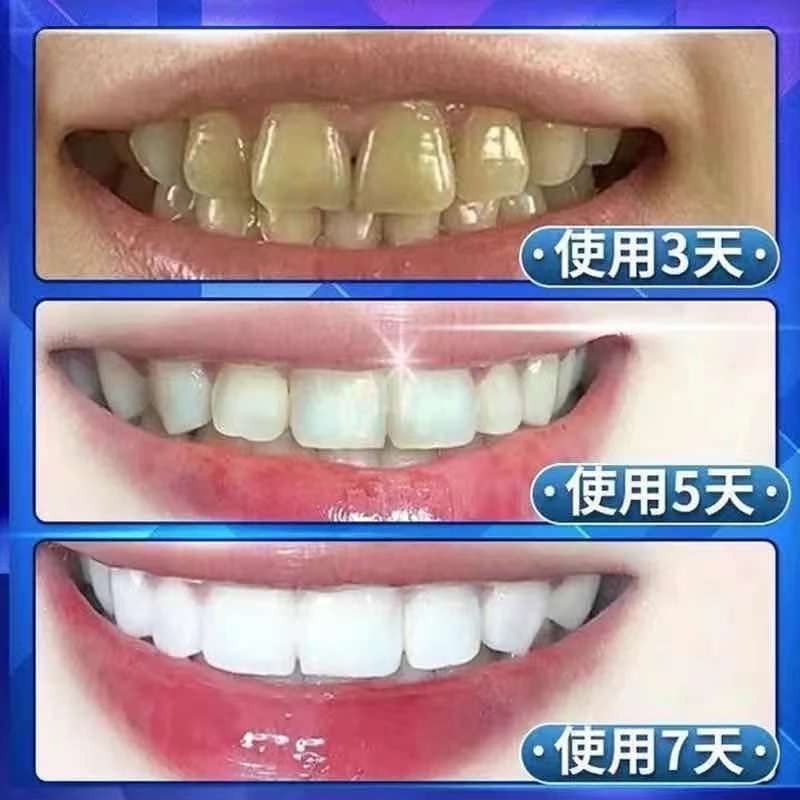 南京同仁堂美白牙贴去黄速效亮白牙齿变白烟渍茶渍洗黄牙贴片牙膏 [一盒]7对14贴(基础净白)