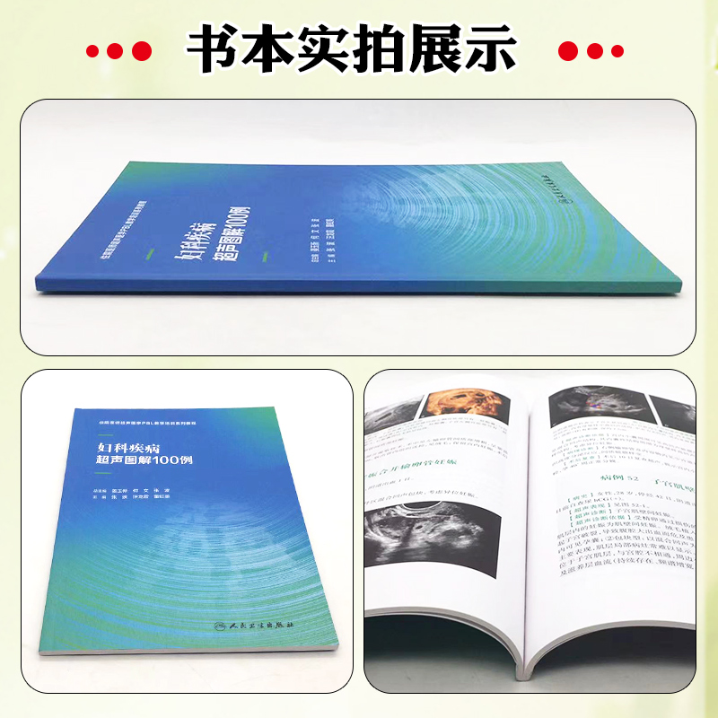 [正版]妇科疾病超声图解100例 人民卫生出版社 9787117346191高清大图