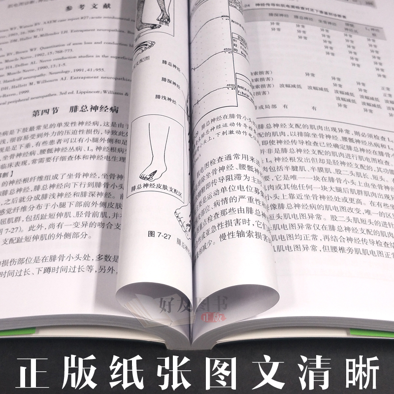 [正版] 肌电图诊断与临床应用 第2版人卫版 党静霞编著 人民卫生出版社9787117181495第二版肌电高清大图