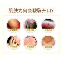 冻裂膏冻疮膏防寒防冻手裂正品手足裂口干燥脱皮脚后跟干裂护手霜