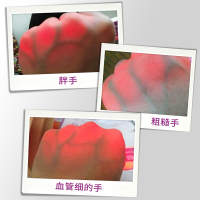 美得（MEIDEMED）静脉穿刺显示仪 血管显像仪 成人老人输液显影仪 儿童打针静脉血管查找仪 康复护理加强型四核四灯芯