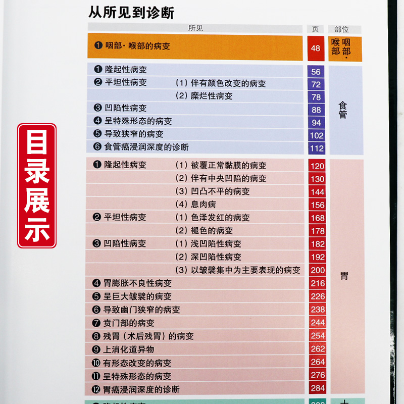 [正版] 内镜诊断与鉴别诊断图谱 上消化道 第二2版 胃镜书 上消化道内镜诊断秘籍 实用消化内科学 临床医学书辽宁科学高清大图