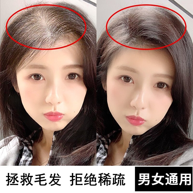 金稻育发按摩梳子增发密发红光健发电动上药器导液生防脱发梳718(象牙白)