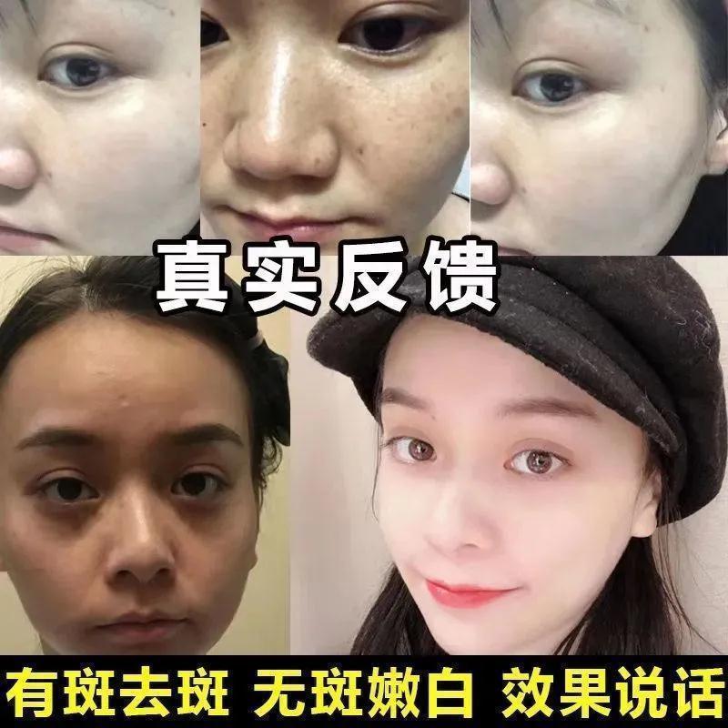 [祛斑霜I]祛斑霜美白淡斑去黄神器雀斑老年斑黄褐斑黑色素 南京同仁堂[美白祛斑霜] 一瓶装