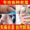 轻度(建议一元面积大小的) 去脚底老茧死皮软化剂祛脚趾头上手足部关节茧去除脚垫脚茧子神器