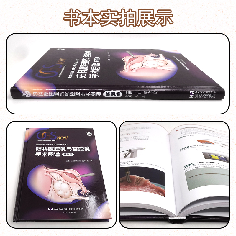 [正版] 妇科腹腔镜与宫腔镜手术图谱基础篇 妇科学书籍 樱木范明主编 辽宁科学技术出版社9787559123664高清大图