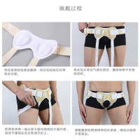 佳禾疝气带医用婴儿小儿腹股沟儿童婴幼儿小肠气宝宝治疗防勒男女