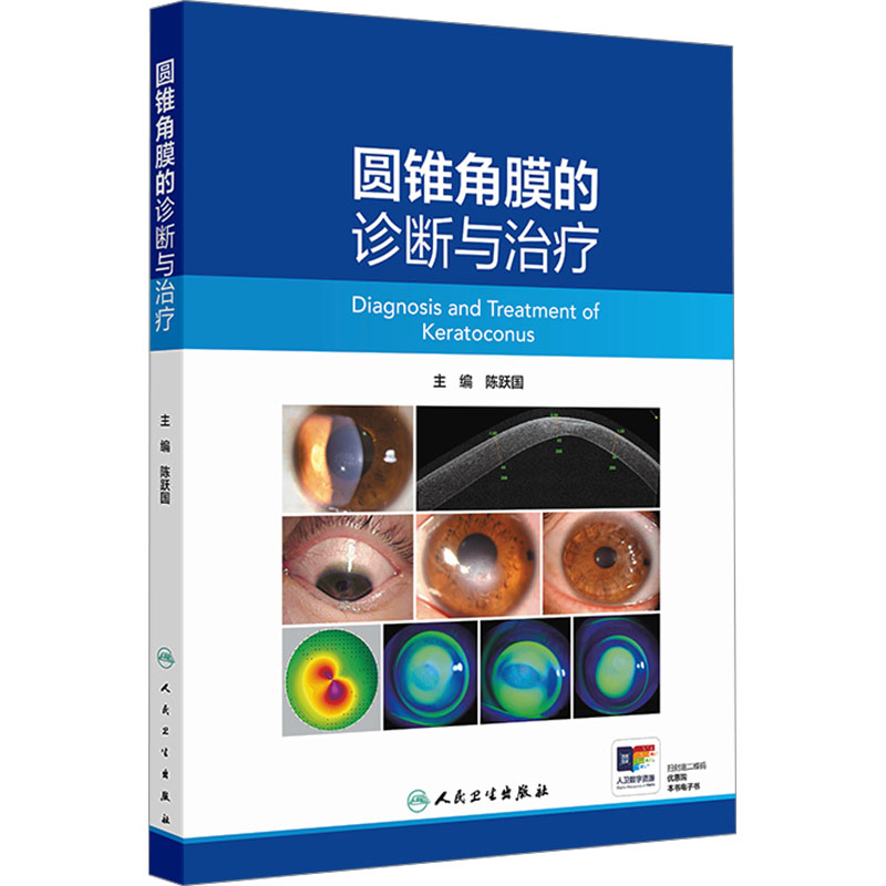 圆锥角膜的诊断与治疗 2024年12月参考书