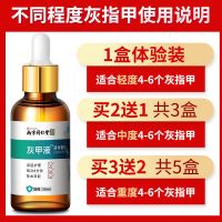 1盒 [轻度灰指甲]送挫刀+黏胶 [同仁堂]灰指甲特效液增厚灰甲亮甲去除灰指甲专用脱甲油抑菌液